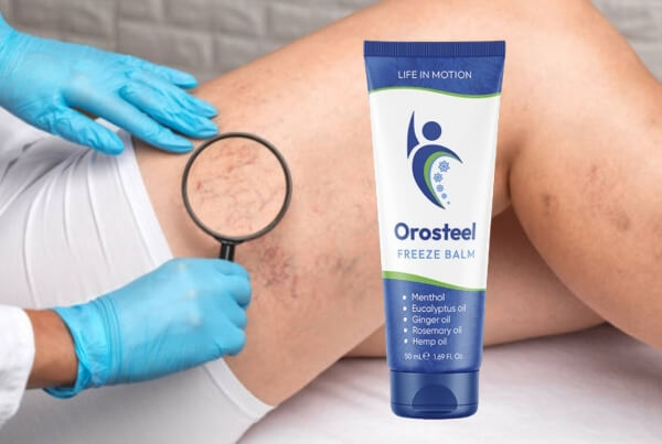 Prezzo di Orosteel in Germania e in Italia